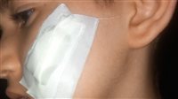 10 غرز وعاهة مستديمة،  تلميذ يعتدي على زميله بـ