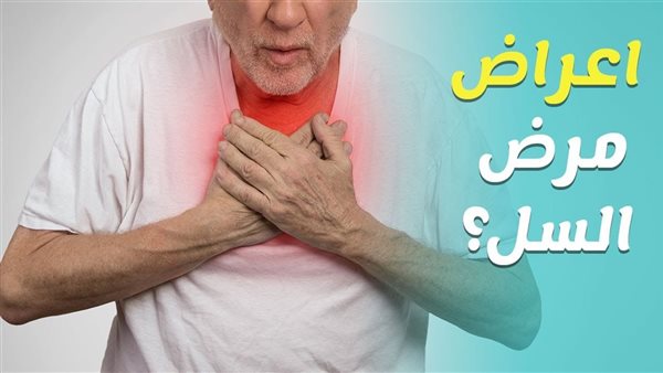 مرض الدرن وطرق الوقاية والعلاج