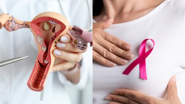 هل يصيب لولب منع الحمل "الهرموني" السيدات بـ سرطان الثدي؟