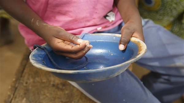 سوء تغذية حاد في جنوب السودان