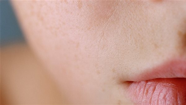 أسباب جفاف البشرة الدهنية في الشتاء وكيفية التعامل معها