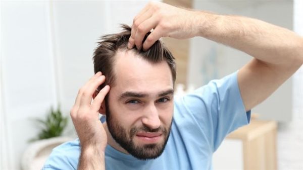 علاج بداية الصلع عند الشباب