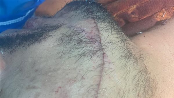 شروع في قتل شاب بحلوان 