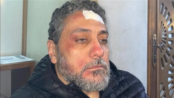 حادث الفنان تامر فرج أثناء تصوير مسلسل محمد هنيدي