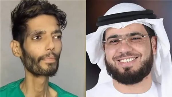 الداعية الإماراتي وسيم يوسف يتكفل بعلاج مرض ابراهيم شيكا 