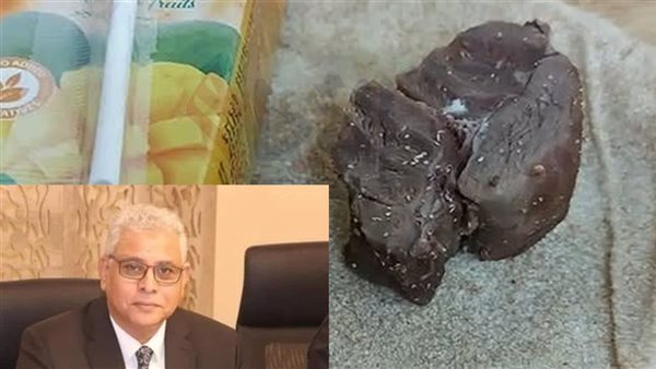 أزمة الوجبات بالمدينة الجامعية لجامعة الأزهر