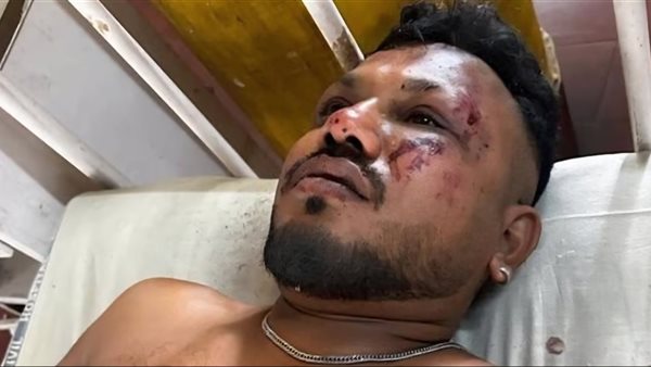 الناجي الوحيد من تحطم الطائرة الهندية يروي تفاصيل مذهلة