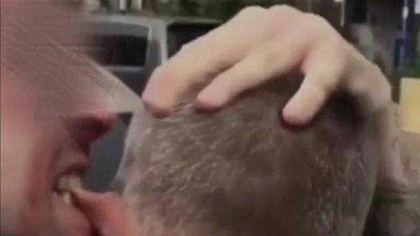 سوري يقضم أذن سائح إسرائيلي على شاطئ يوناني 