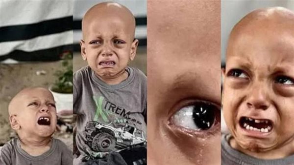 الطفل الفلسطيني عبد الله أبو زرقة 