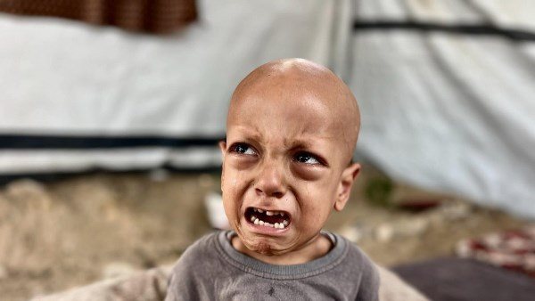 التجويع الإسرائيلي لغزة يقتل رضيعة عمرها 5 شهور