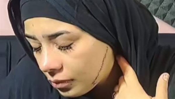 حادث فتاة مصر القديمة منصورة