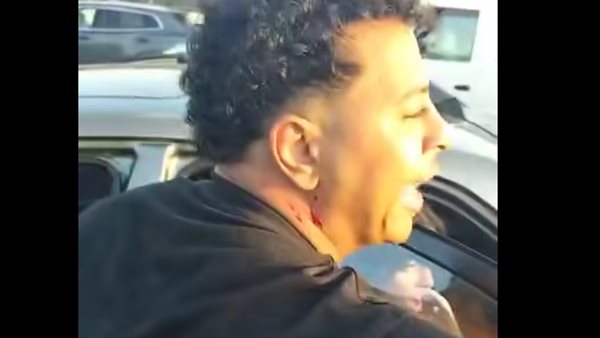 فعل فاضح على المحور