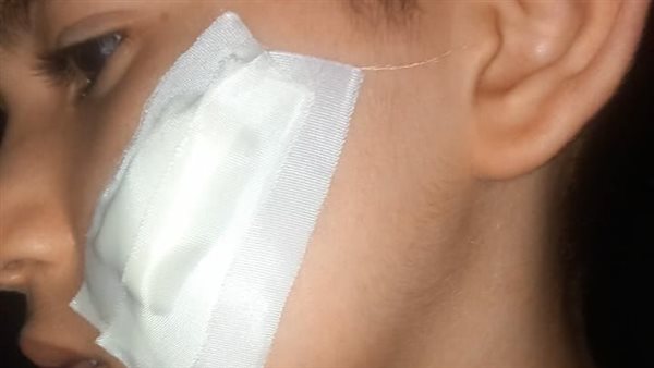 تلميذ يعتدي على زميله بـ"كتر" في عين حلوان