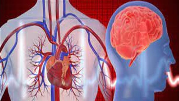 التدخين أخطرها، دراسة تكشف 99% من أسباب السكتات الدماغية