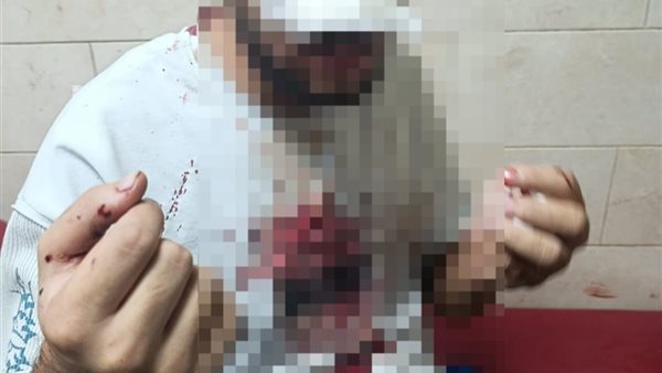 إصابة 3 أشخاص لتعرضهم للأعتداء من قبل 8 أشخاص بالطالبية