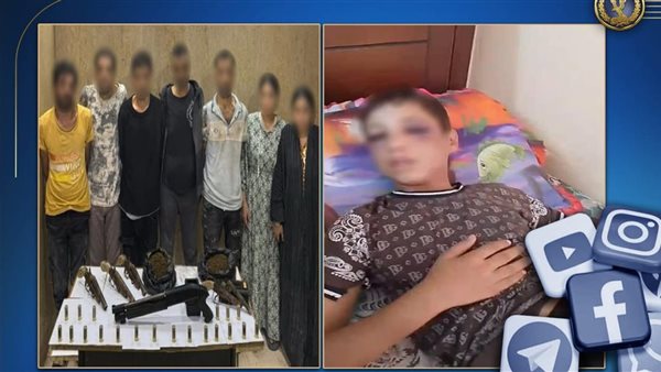 اعترافات المتسبب في إصابة طفل في القاهرة