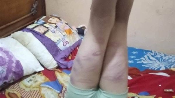  أب يقوم بتعذيب أبنه