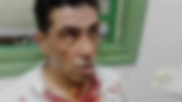 المجني عليه في اعتداء الهرم