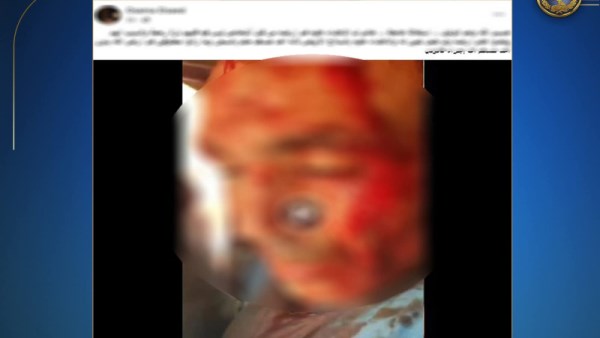 صورة أحد مصابي المشاجرة 