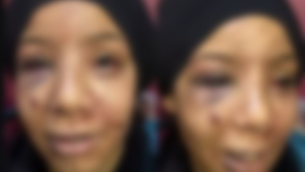 طفلة بلبيس