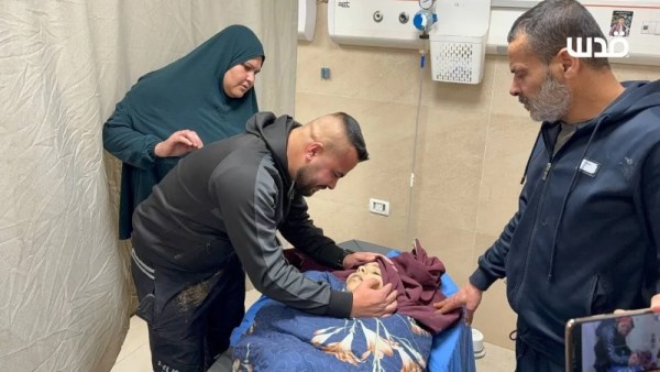 إحدى الأطفال المصابون في قطاع غزة