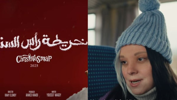 علاما متلازمة داون 
