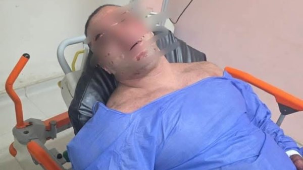 إصابة الديزل مدير جيم شهير بالشيخ زايد