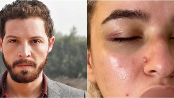 واقعة ضرب الفنان محمود حجازي لزوجته