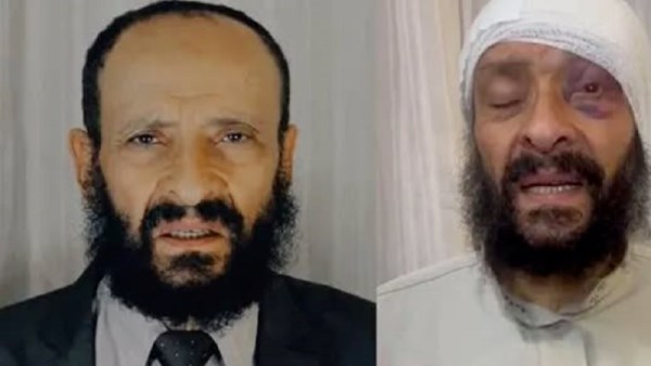طبيب مصري بالسعودية