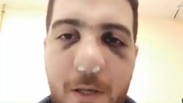 طبيب المنوفية المعتدى عليه