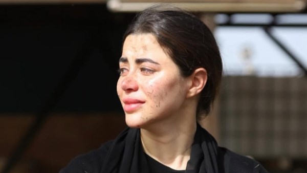 يارا السكري 