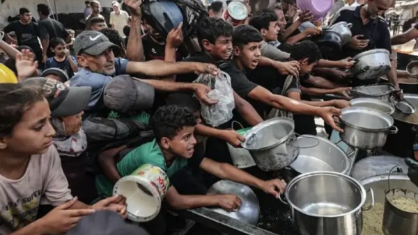 نقص حاد في التغذية