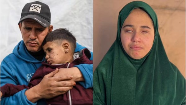  خطر العمى يهدد فلسطين