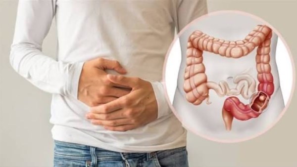 7 مشروبات طبيعية لتهدئة القولون بعد أكلات العيد الدسمة