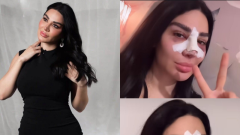 سارة نخلة تكشف تفاصيل عمليتها في الأنف: تدخل جراحي ضروري بعد تدهور التنفس