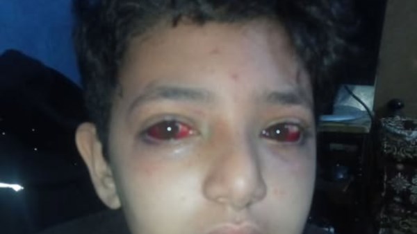 الطالب المعتدى عليه 