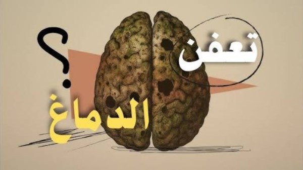 التعفن الدماغي