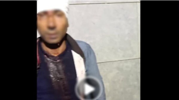حقيقة الاعتداء على شخص