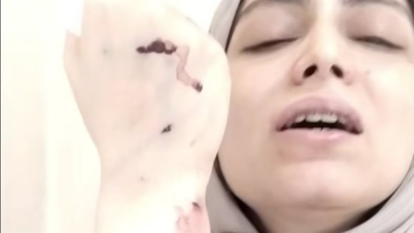 طبيبة أسنان شبرا الخيمة