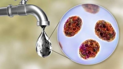  4 أمراض خطيرة تهددك في الصيف   