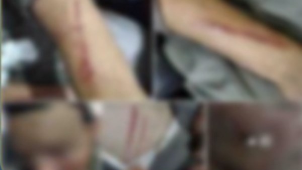 تفاصيل الاعتداء على شخص بالشرقية